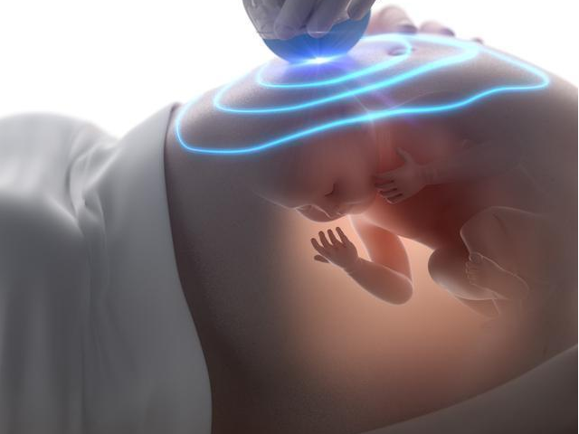 胎儿畸形可能是遗传因素
