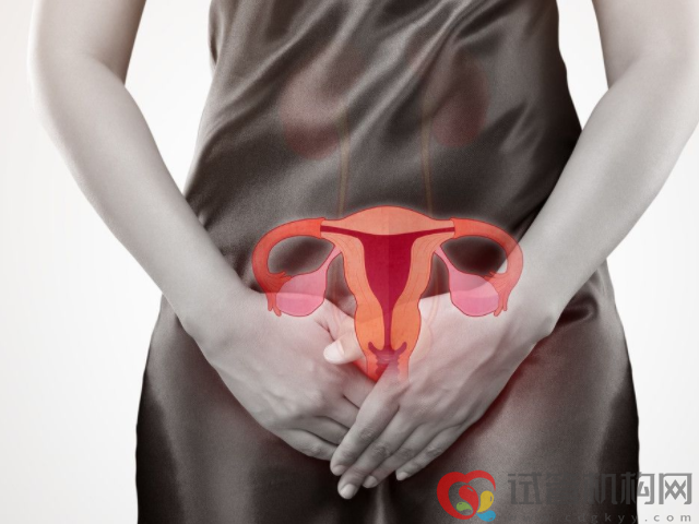 子宫内膜异位症的有四种类型